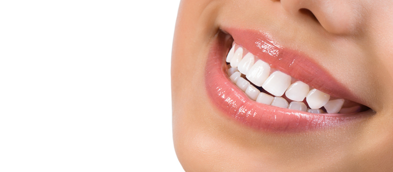 目立つ銀歯でお悩みの方へ～白く美しい歯を取り戻す審美歯科治療～