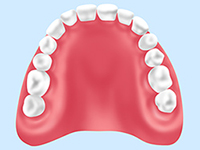 入れ歯（保険適用）