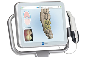 最新の口腔スキャナiTero Element（アイテロ エレメント）