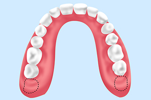 親知らずって、どんな歯？
